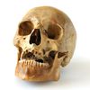 Skull, Evidence Of "Ritual Sacrifice" Found In Bronx